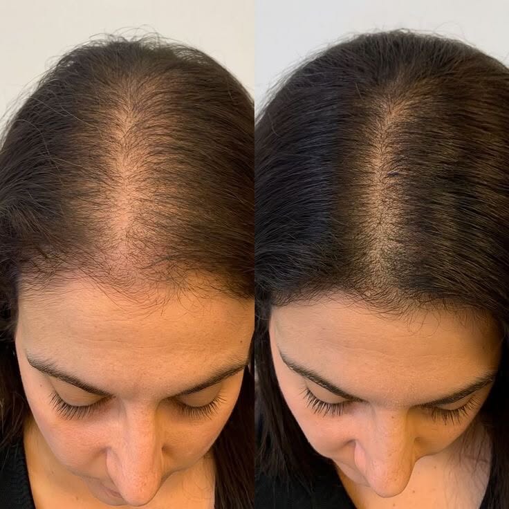 🌿 Mielle Rosemary Mint  Fortalece y nutre tu cabello desde la raíz